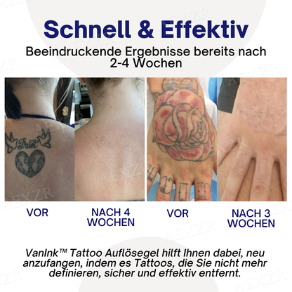 VanInk™ Tattoo Auflösegel